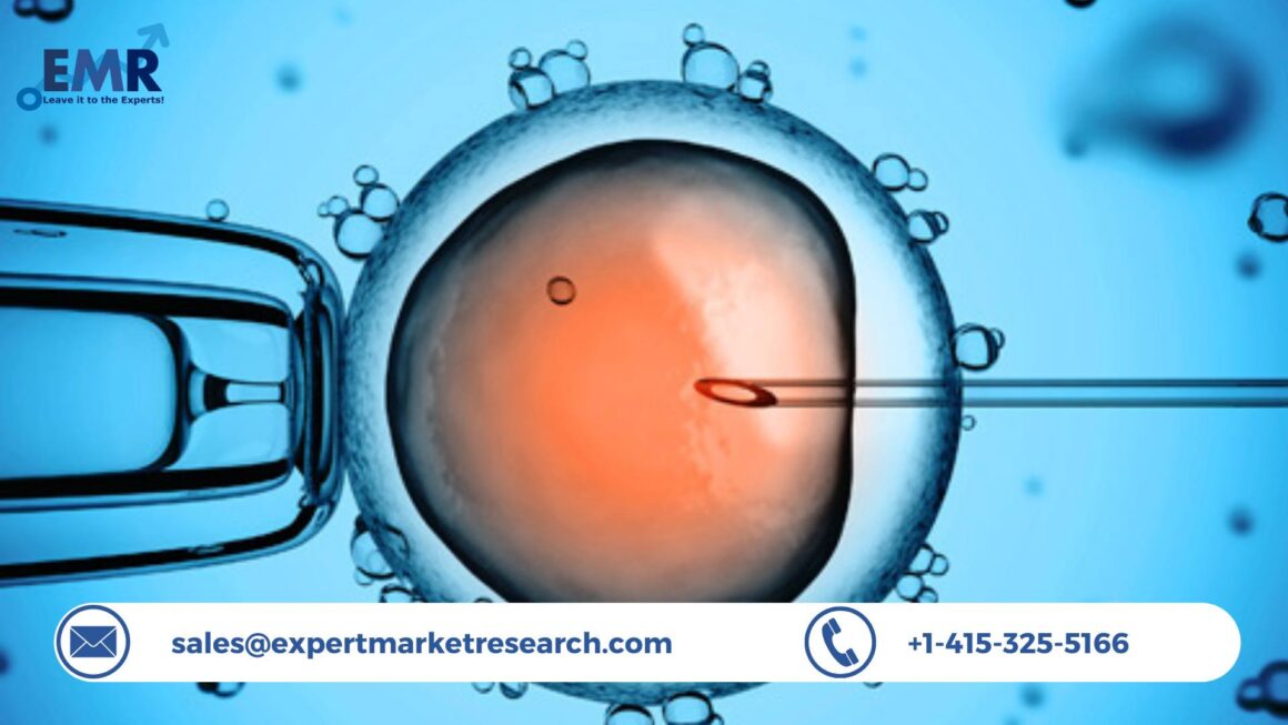Global Assisted Reproductive Technology Market Size, Share, Report, Growth, Key Players, Forecast 2023-2028