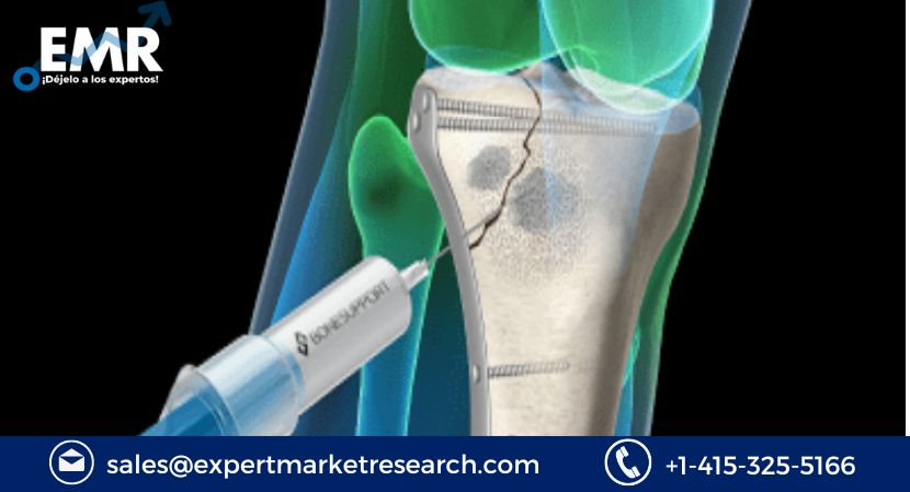 Bone Void Fillers Market: A Comprehensive Overview of the Industry’s Players and Trends