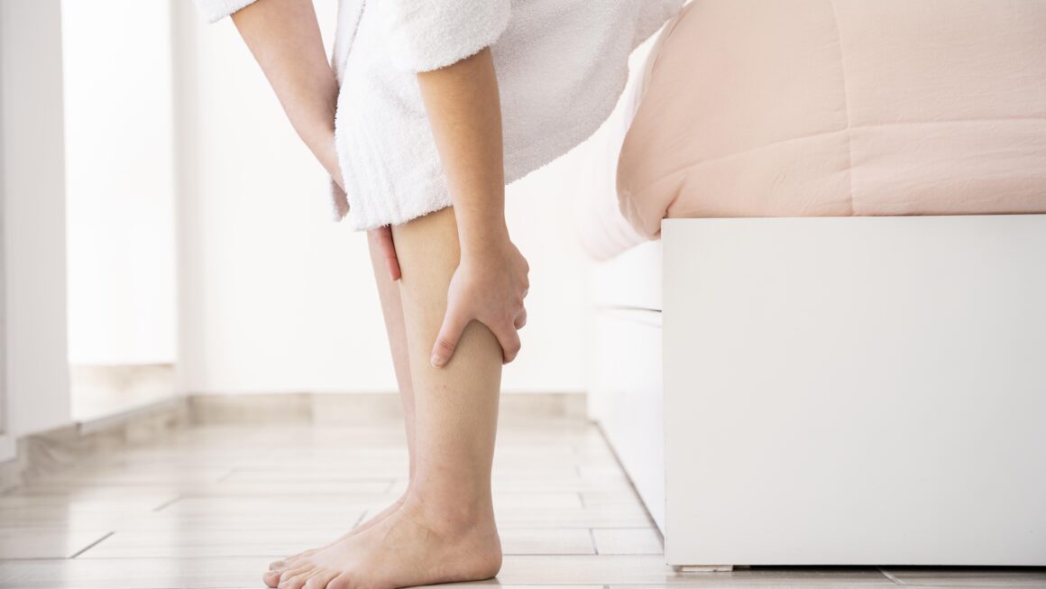 Debunking Common Misconceptions About Varicose Veins
