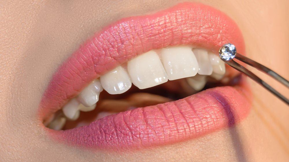 Tooth Jewellery: Fashion and Dentistry Go Hand in Hand
