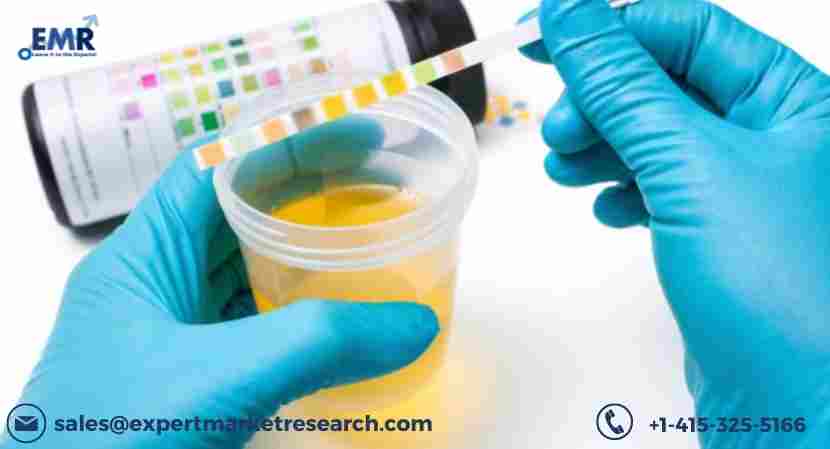 Global Urinalysis Market Size, Key Facts, Dynamics, Segments and Forecast Predictions 2023-2028