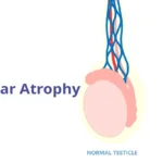 natural remedies for testicular atrophy