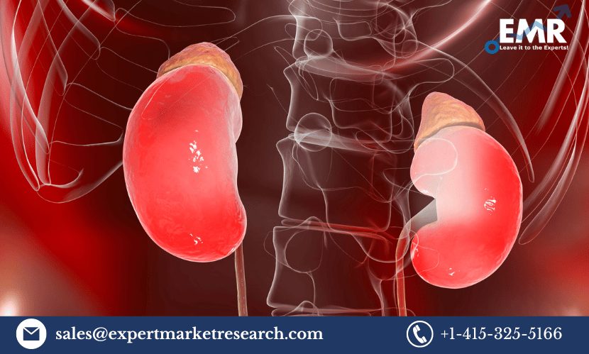 Congenital Adrenal Hyperplasia (CAH) Treatment Market Size, Share, Price, Trends, Growth, Analysis, Report, Forecast 2023-2031