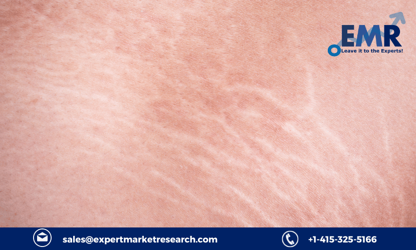 Stretch Marks Treatment Market Size, Share, Price, Trends, Growth, Analysis, Report, Forecast 2023-2028