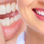 Transforming Your Teeth with Cosmetic Dentistry Techniques