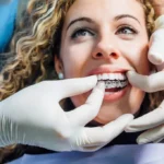 Invisalign Dentistry in Chandler