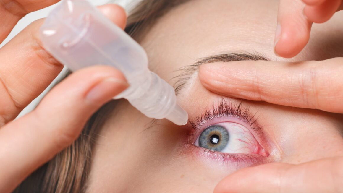 dry eye treatment in Oakville