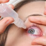 dry eye treatment in Oakville