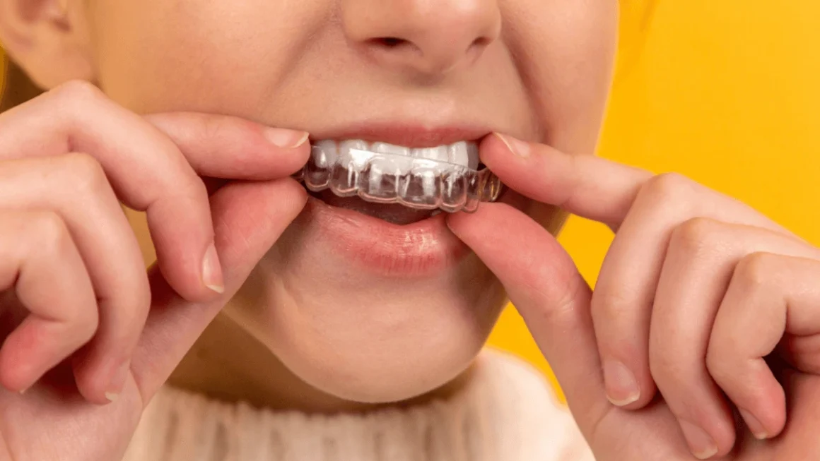 Transform Your Smile with Invisalign Dentistry in Chandler