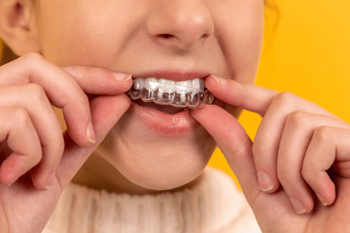 Invisalign dentistry in Chandler