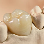 Restorative Dentistry in Mesa
