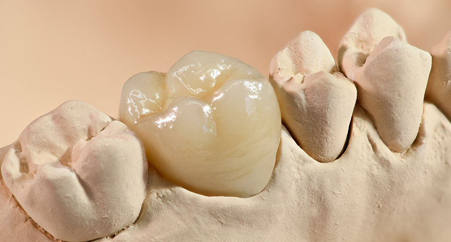 Everything You Need to Know About Tooth Extractions in Tempe