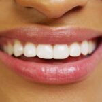 restorative dentistry in Phoenix