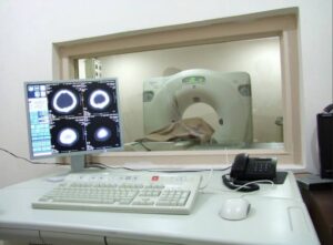 What Is a Nerve Specialist Doctor Called? When to Visit a Hospital in Ranchi
